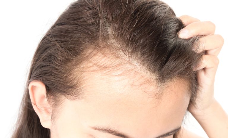 9 Hairstyles To Cover Bald Spots | At Length by Prose Hair